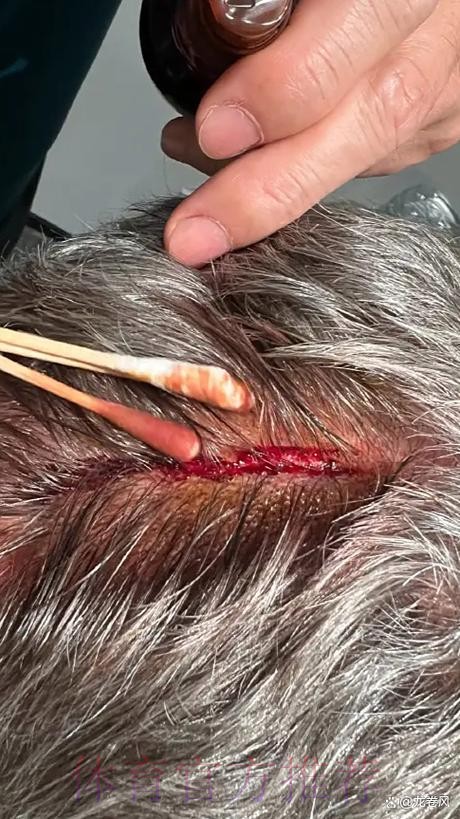 五甲联赛北二区小组赛次日战罢 出线之争进入“白热化”状态